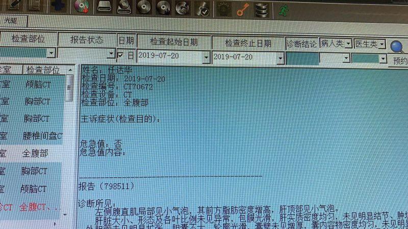 任達華被襲擊 事后發微信求助所幸任達華無大礙
